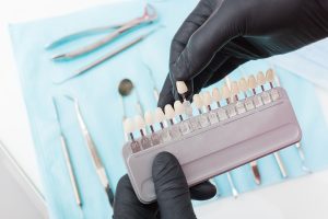 Dantų laminatės (venyrai) Vilniuje - Slėnio odontologijos klinika