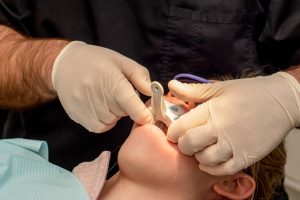Endodontinis gydymas Vilniuje | Slenio odontologijos klinika